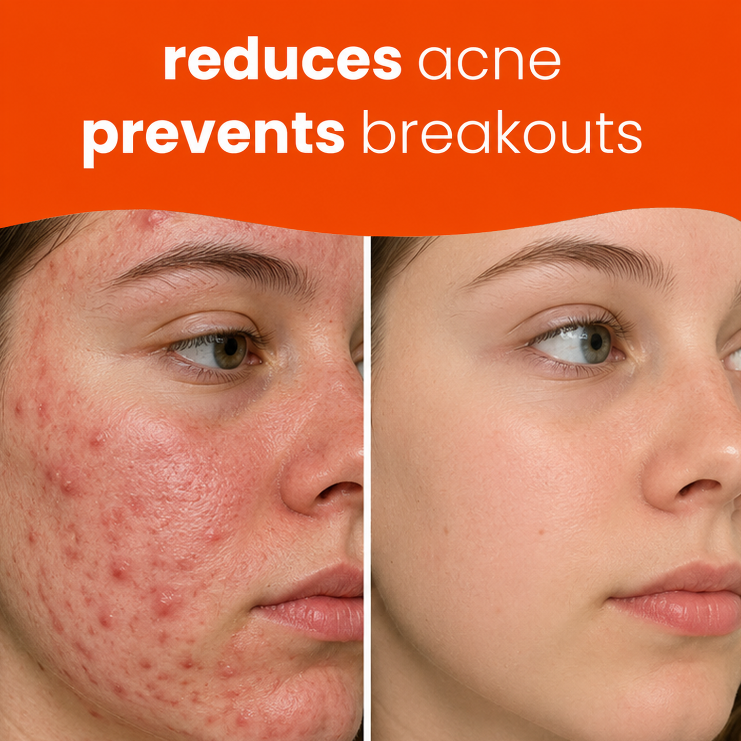 🔥Last Day 68% OFF-Prionne Turmeric Kojic Glow Pads