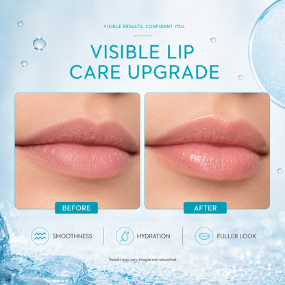 Prionne Micro-Spicule Plumping Lip Booster