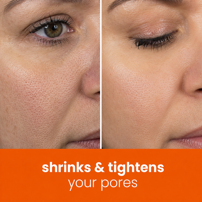 🔥Last Day 68% OFF-Prionne Turmeric Kojic Glow Pads