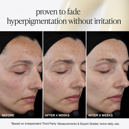 Aurawhispers✨Last day of promotion💧 Brightening Serum-Helps improve dull skin texture and leaves appearance brighter.